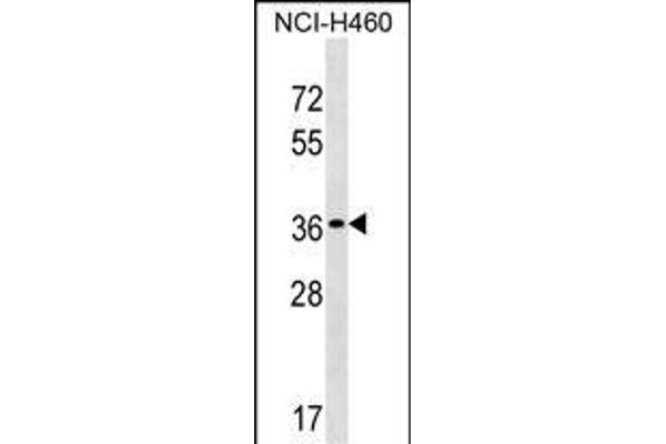 TP53TG5 抗体  (AA 134-161)