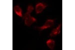 Image no. 3 for anti-MutS Homolog 3 (MSH3) (N-Term) antibody (ABIN6263385)