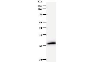 anti-N(alpha)-Acetyltransferase 38, NatC Auxiliary Subunit (NAA38) antibody