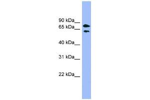 Image no. 1 for anti-Pantothenate Kinase 4 (PANK4) (Middle Region) antibody (ABIN2787089)