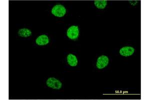 Image no. 3 for anti-Mirror-Image Polydactyly 1 (MIPOL1) (AA 321-423) antibody (ABIN530890)