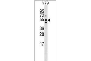 BRUNOL5 Antibody (Center) (ABIN1538032 and ABIN2849816) western blot analysis in Y79 cell line lysates (35 μg/lane).