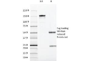Image no. 5 for anti-SRY (Sex Determining Region Y)-Box 10 (SOX10) (AA 115-269) antibody (ABIN6940623)