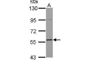 anti-Protein AF-9 (MLLT3) (Center) antibody