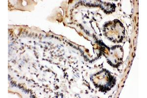 Image no. 2 for anti-FBJ Murine Osteosarcoma Viral Oncogene Homolog B (FOSB) (AA 264-291), (C-Term) antibody (ABIN3042399)