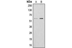 Image no. 1 for anti-Aldehyde Dehydrogenase 1 Family, Member B1 (ALDH1B1) (Center) antibody (ABIN2705432)