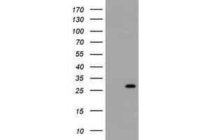 Image no. 2 for anti-Ras-Like Without CAAX 2 (RIT2) antibody (ABIN1500714)