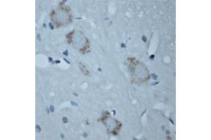 Image no. 2 for anti-Solute Carrier Family 18 (Vesicular Acetylcholine), Member 3 (SLC18A3) (AA 450-505) antibody (ABIN351375)