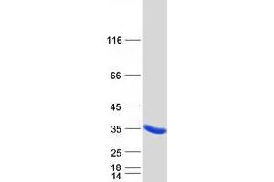 Image no. 1 for Phosphomannomutase 1 (PMM1) protein (Myc-DYKDDDDK Tag) (ABIN2729211)