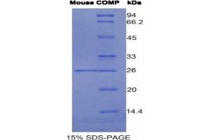 Image no. 2 for Cartilage Oligomeric Matrix Protein (COMP) ELISA Kit (ABIN6720567)