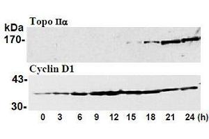 Image no. 1 for anti-Topoisomerase (DNA) II alpha 170kDa (TOP2A) antibody (ABIN1109281)