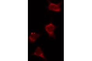Image no. 2 for anti-Phosphoinositide 3 Kinase, p85 beta (PI3K p85b) (C-Term) antibody (ABIN6264187)