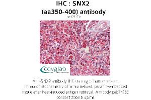 Image no. 2 for anti-Sorting Nexin 2 (SNX2) (AA 350-400) antibody (ABIN1739490)