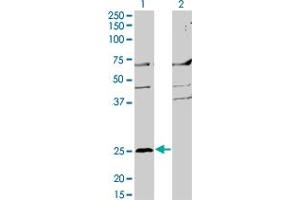 anti-Membrane-Spanning 4-Domains, Subfamily A, Member 2 (Fc Fragment of IgE, High Affinity I, Receptor For, beta Polypeptide) (MS4A2) (AA 1-59) antibody