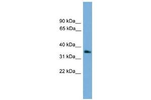 Image no. 1 for anti-Guanine Nucleotide Binding Protein (G Protein), beta Polypeptide 4 (GNB4) (Middle Region) antibody (ABIN928969)