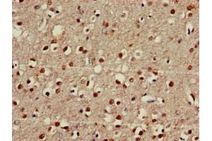 Immunohistochemistry of paraffin-embedded human brain tissue using ABIN7152527 at dilution of 1:100