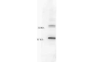 Image no. 1 for anti-Interleukin 10 (IL10) antibody (ABIN5706825)