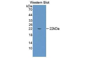 Image no. 1 for anti-Molybdenum Cofactor Synthesis 1 (MOCS1) (AA 1-160) antibody (ABIN5013957)