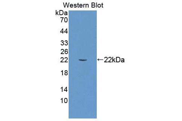 anti-Molybdenum Cofactor Synthesis 1 (MOCS1) (AA 1-160) antibody