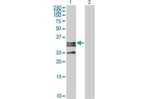 Western Blot analysis of C1QTNF2 expression in transfected 293T cell line by C1QTNF2 monoclonal antibody (M01), clone 1D7-2C7.
