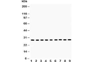 Image no. 4 for anti-Peroxiredoxin 3 (PRDX3) (AA 110-256) antibody (ABIN3032189)