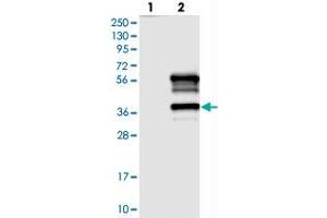 Image no. 1 for anti-Tetratricopeptide Repeat Domain 19 (TTC19) antibody (ABIN5590326)