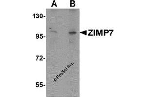 Western Blotting (WB) image for anti-Zinc Finger, MIZ-Type Containing 2 (ZMIZ2) (Middle Region) antibody (ABIN1031174)