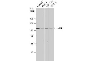 Image no. 4 for anti-Eukaryotic Translation Elongation Factor 2 (EEF2) (Internal Region) antibody (ABIN2855346)