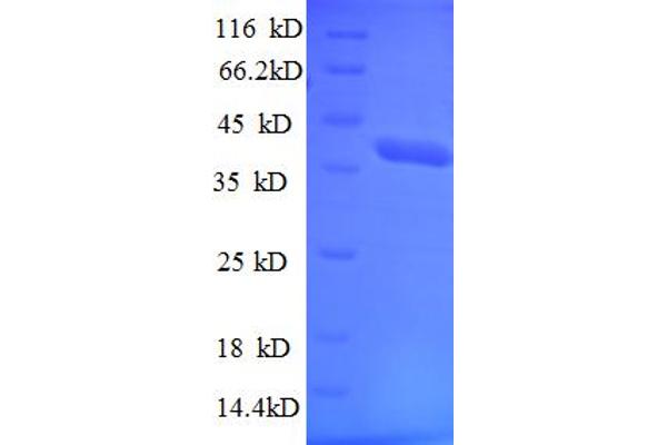 TRIM11 Protein (AA 267-468, partial) (His-SUMO Tag)