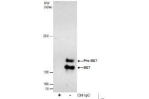 Image no. 4 for anti-Met Proto-Oncogene (MET) (C-Term) antibody (ABIN2854819)