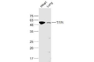 Image no. 1 for anti-Tissue Factor Pathway Inhibitor (Lipoprotein-Associated Coagulation Inhibitor) (TFPI) (AA 101-200) antibody (ABIN741690)