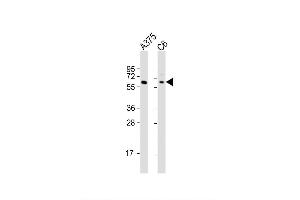 Image no. 5 for anti-SRY (Sex Determining Region Y)-Box 10 (SOX10) (AA 231-259) antibody (ABIN652035)