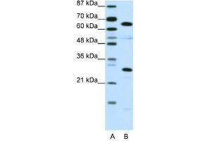 Image no. 1 for anti-High Mobility Group Box 4 (HMGB4) (C-Term) antibody (ABIN927872)