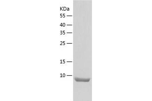 Osteocrin Protein (OSTN) (AA 28-133) (His tag)