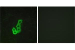 Image no. 2 for anti-Dopamine Receptor D1 (DRD1) (AA 135-184) antibody (ABIN1535584)