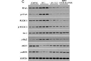 Image no. 1 for anti-Myosin Regulatory Light Chain 2, Smooth Muscle Isoform (MYL9) (pThr19) antibody (ABIN753238)