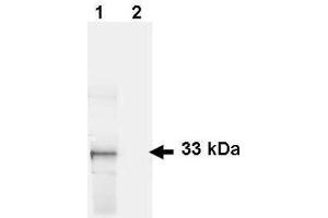 Image no. 1 for anti-Green Fluorescent Protein (GFP) antibody (ABIN100085)