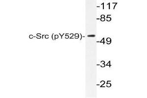 Image no. 2 for anti-Nuclear Receptor Coactivator 1 (NCOA1) (pTyr529) antibody (ABIN498717)