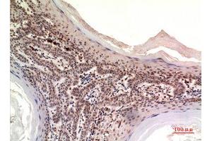 Image no. 2 for anti-Nephroblastoma Overexpressed (NOV) (Internal Region) antibody (ABIN3187913)