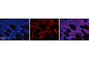 Image no. 2 for anti-Nuclear Receptor Subfamily 4, Group A, Member 2 (NR4A2) (C-Term) antibody (ABIN2777552)