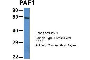 Image no. 2 for anti-Paf1, RNA Polymerase II Associated Factor, Homolog (PAF1) (N-Term) antibody (ABIN2788815)