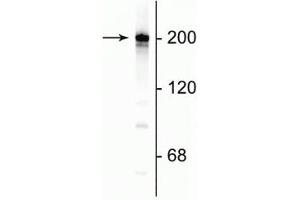 Image no. 2 for anti-Neurofilament, Heavy Polypeptide (NEFH) antibody (ABIN361350)