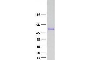 SKA3 Protein (Transcript Variant 2) (Myc-DYKDDDDK Tag)