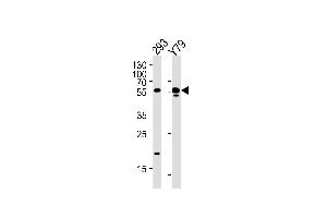 Image no. 2 for anti-Aldehyde Dehydrogenase 1 Family, Member A3 (ALDH1A3) (N-Term) antibody (ABIN2157667)