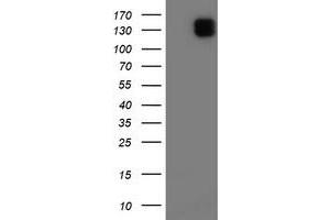 Image no. 1 for anti-Glutamyl Aminopeptidase (Aminopeptidase A) (ENPEP) antibody (ABIN2717633)