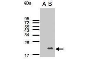 WB Image Western Blot analysis of UBE2C expression in transfected 293T cell line by UBE2C polyclonal antibody.