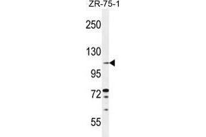 Image no. 2 for anti-Tolloid-Like 2 (TLL2) (AA 305-336), (Middle Region) antibody (ABIN955234)