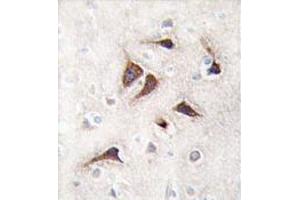 Image no. 1 for anti-Calcium/calmodulin-Dependent Protein Kinase II delta (CAMK2D) (C-Term) antibody (ABIN359403)