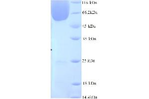 Image no. 1 for BCL2-Associated Athanogene 3 (BAG3) (AA 2-577) protein (His tag) (ABIN5714470)