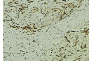 Image no. 1 for anti-Synovial Sarcoma Translocation Gene On Chromosome 18-Like 1 (SS18L1) antibody (ABIN6261030)